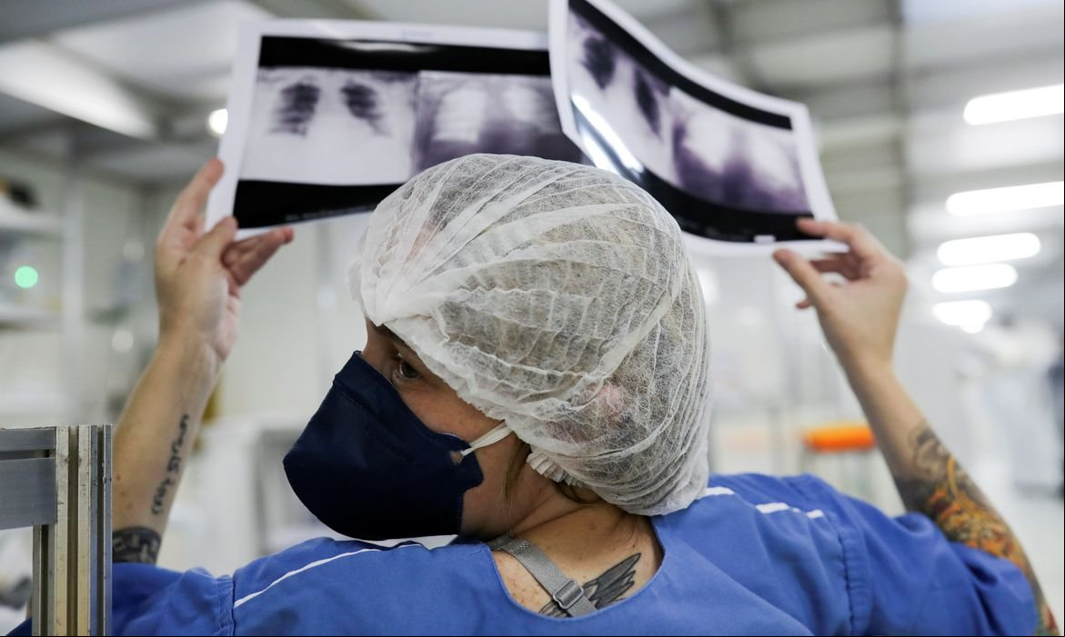 Síndromes respiratórias se aproximam de menor patamar da pandemia